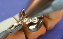 secondary crown to partial